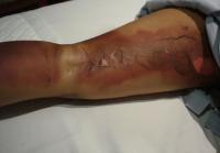 post-101363-1266823181_thumb.jpg