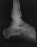 post-77518-0-12641600-1297951774_thumb.j