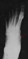 post-77518-0-48604700-1297951766_thumb.j
