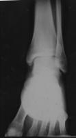 post-77518-0-56931700-1297951781_thumb.j