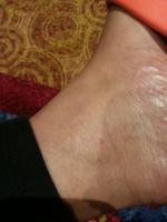 post-203243-0-56250800-1393383959_thumb.