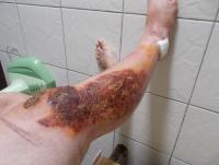post-214498-0-10972600-1423666548_thumb.