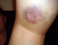 post-87166-0-06825400-1424225661_thumb.j