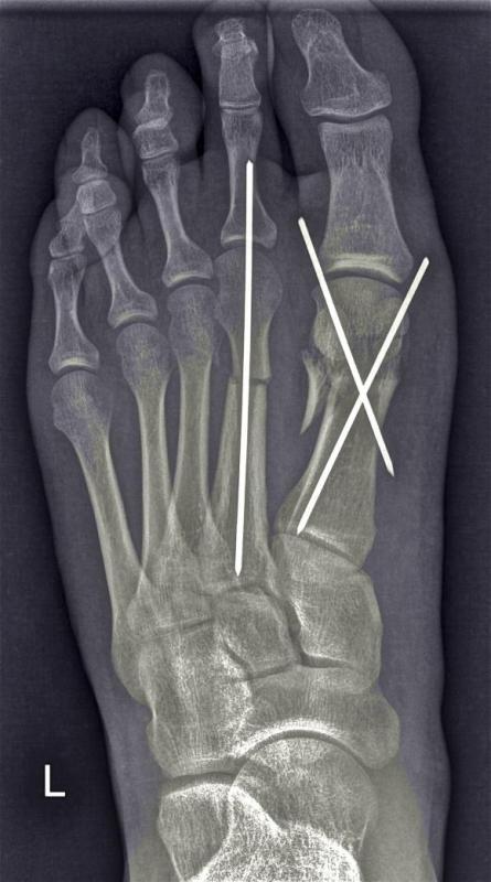 post-179384-0-27128100-1456147180_thumb.