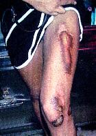 post-4665-0-24474600-1299495441_thumb.jp