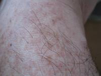 post-117644-0-10251000-1331879938_thumb.