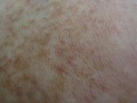 post-117644-0-38399700-1331879986_thumb.