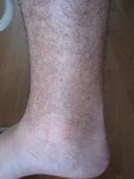 post-117644-0-83723800-1331879805_thumb.