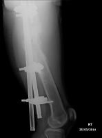 post-124398-0-31605000-1395740828_thumb.