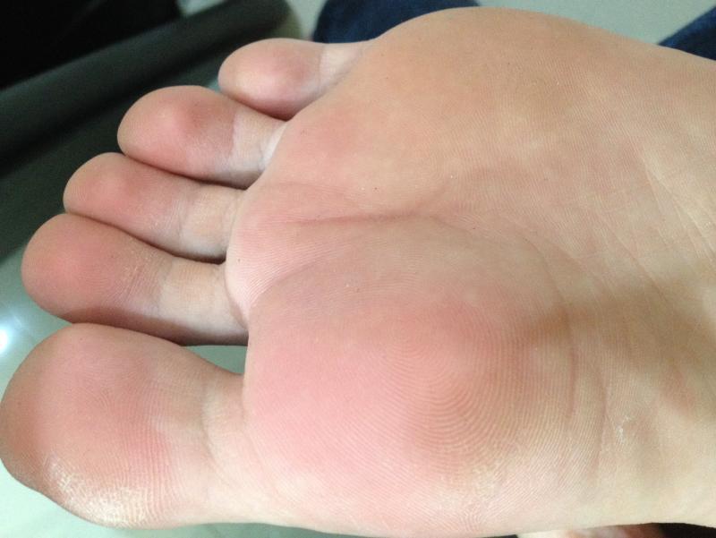 post-118654-0-31586200-1426736979_thumb.