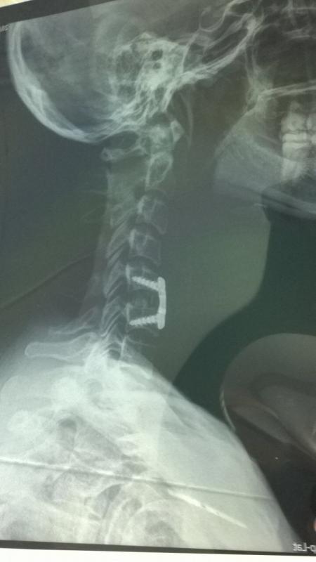 post-20874-0-66876600-1426254584_thumb.j