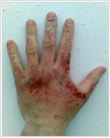post-23436-1271724511_thumb.jpg