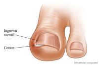 post-37101-0-83624000-1398074830_thumb.j