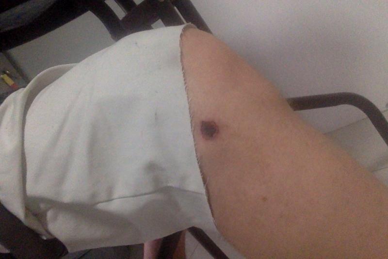 post-174911-0-15626400-1428385639_thumb.
