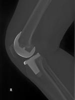 post-111567-0-62492500-1400166400_thumb.