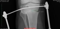 post-25605-0-42261600-1399792719_thumb.j