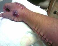 post-41583-1245146248_thumb.jpg