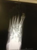 post-156282-13394624954_thumb.jpg