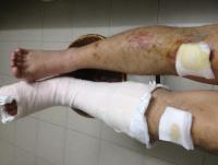 post-146288-0-26208600-1343755523_thumb.