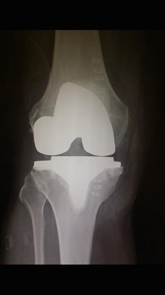 post-24771-0-71004400-1437727548_thumb.j