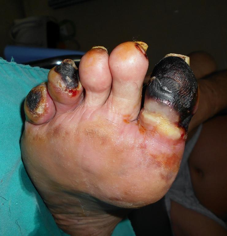 post-14979-0-08949300-1469578379_thumb.j