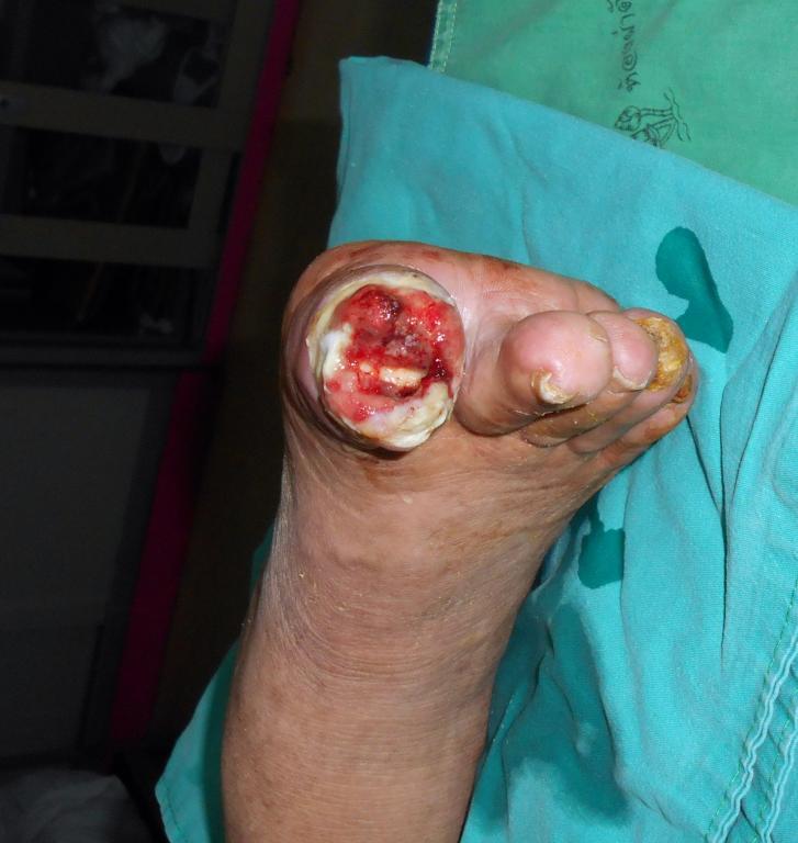 post-14979-0-64015600-1469578396_thumb.j