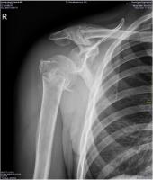 post-130013-0-70515700-1314530030_thumb.