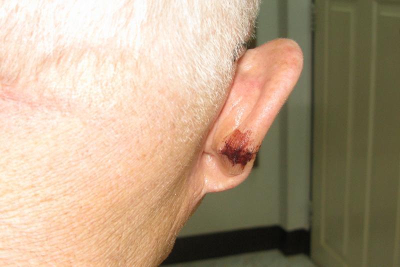 post-192388-0-53910200-1440038982_thumb.
