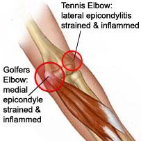 post-198206-0-73432500-1438410107_thumb.