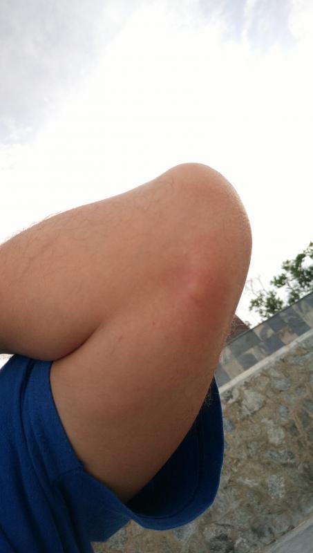 post-239633-0-54562100-1439493895_thumb.