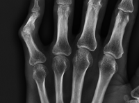 post-4090-069256300 1283351221_thumb.png