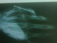 post-4090-081505300 1283351273_thumb.jpg