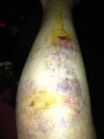 post-24771-0-44076200-1346715151_thumb.j