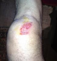 post-24771-0-81500700-1346715160_thumb.j