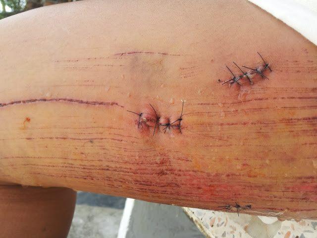 post-242586-0-99684800-1441276310_thumb.