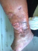 post-202610-0-58009500-1414057354_thumb.