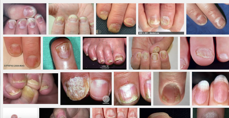 post-216306-0-14982500-1446435614_thumb.