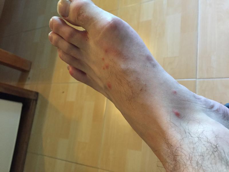 post-249715-0-04245800-1448598826_thumb.