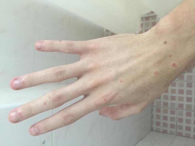 post-249715-0-28689700-1448598786_thumb.