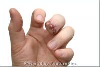 post-32929-1166683463_thumb.jpg