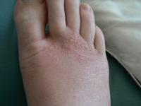 post-32772-0-39562200-1356747542_thumb.j