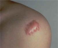 post-73727-0-85849000-1354930552_thumb.j