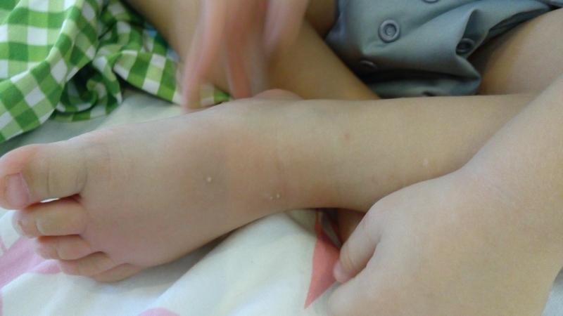 post-251071-0-82446500-1450773418_thumb.