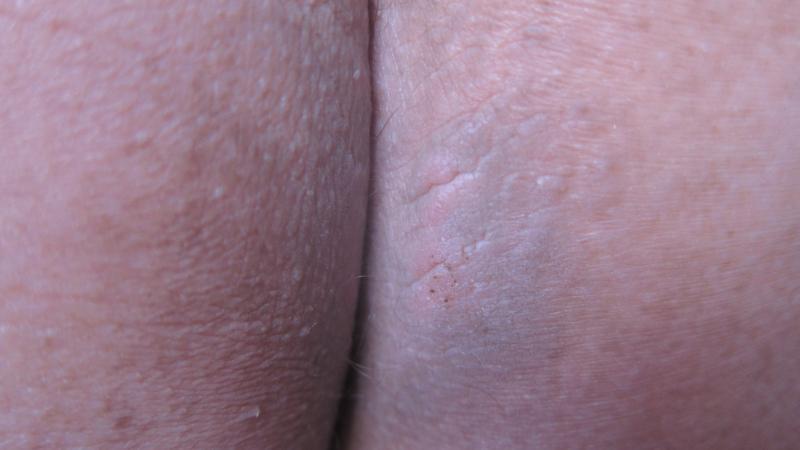 post-25991-0-53228200-1449119055_thumb.j