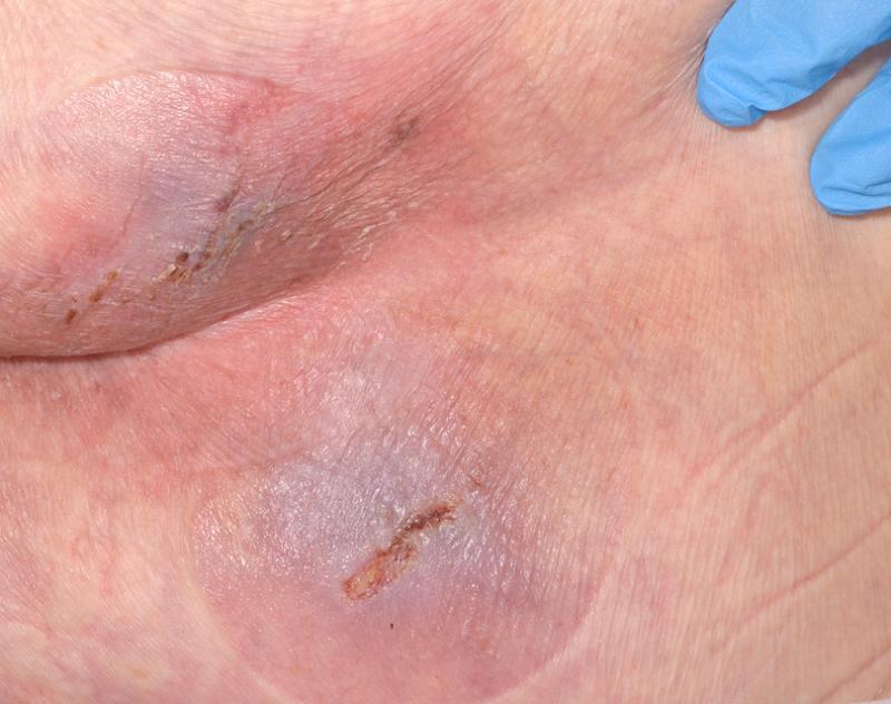 post-25991-0-93392700-1449119034_thumb.j