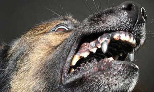 Titanium teeth.jpg