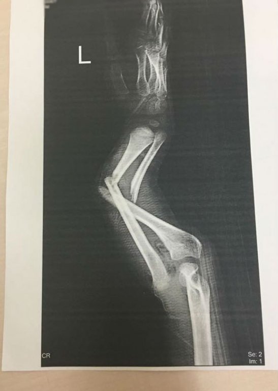 x-ray1.jpg.892da70e182d9383922fff4f97eaa54b.jpg