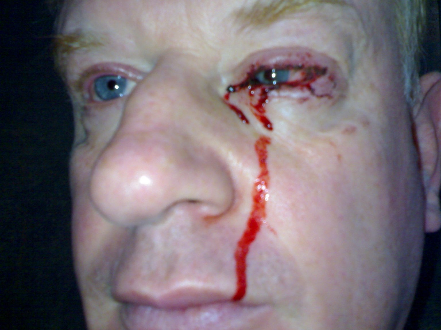 chris eye and noi family 023.jpg
