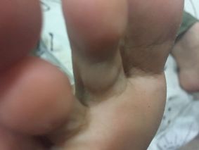 595129fe8f65e_Cyst2.jpg.9ebdf658f109c3b553ca3327ce68c7f2.jpg