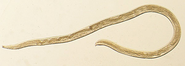 2018-02-12T222406Z_1_LYNXMPEE1B1UN_RTROPTP_4_USA-HEALTH-EYEWORMS.JPG